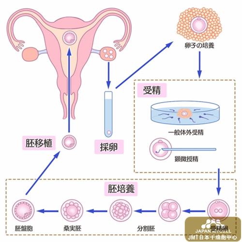 体外受精过程流程图 