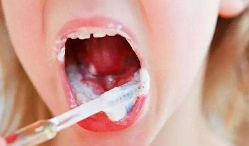 刷牙时牙膏 该不该 沾水 很多人都没弄明白,难怪牙黄还有口气