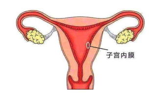 多囊合并子宫内膜薄，还可以试管成功助孕吗?