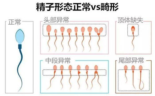 男人四十要娃不迟 超过39岁都不建议捐精了