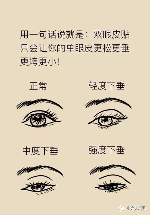 双眼皮贴贴久了会变成双眼皮 信这个邪你就算毁了