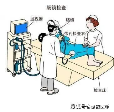 听说做肠镜很痛苦,到底要不要做 听听消化科专家的建议