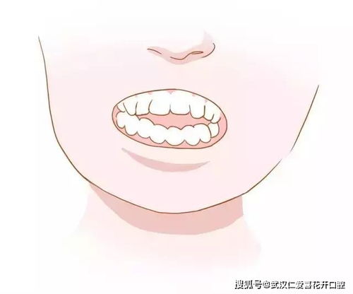 这么多种牙齿畸形,不矫正有什么影响吗