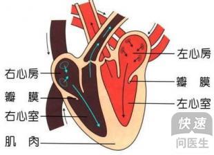 探究心肌缺血的病因是什么