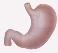 胃穿孔症状 胃穿孔有什么表现症状胃穿孔的6大症状