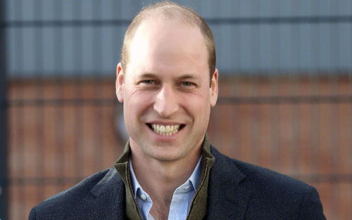威廉王子秃顶？威廉王子被评为世界最性感秃顶男人,主要有哪些原因