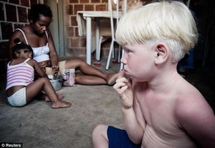 巴西黑人母亲生出5个孩子,3个却得了白化病 