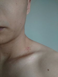 脖子皮肤起了这几个红点 今天发现的,这是什么,会不会全身都长的,好害怕,这能好吗 