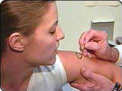 天花疫苗现在还打吗,天花疫苗是一个历史悠久的疫苗，曾经被广泛使用，以预防天花病毒的感