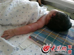 分娩拽伤婴儿手臂神经 东营胜利医院称孩子太大 