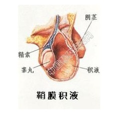 宝宝做鞘膜积液手术