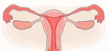子宫内膜异位导致怀不上，可以做试管婴儿吗?