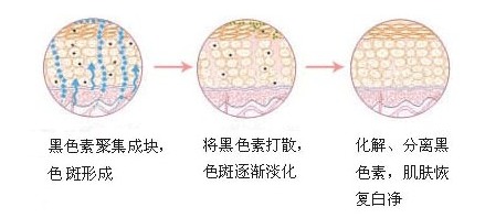 关于斑的知识