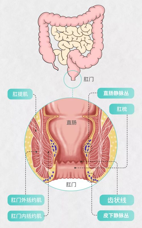 取痔吉日（痔疮割除的最佳时机是什么？）