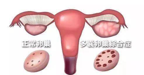 3年没怀孕 被 离婚,到医院一查,竟是这个原因