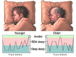 只有深度睡眠才是好睡眠 关于深睡的3个小知识 