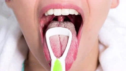 表情 刷牙到底要不要清理舌苔 坚持刷舌苔,你会发现这几个惊人变化 ... 表情 