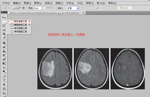 PS处理图片如何加序号和方框 如图 