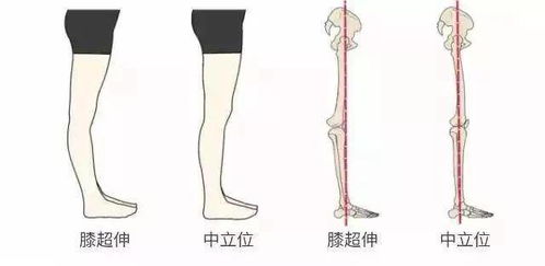 哪些方法可以瘦腿呢(什么方法可以瘦腿?)