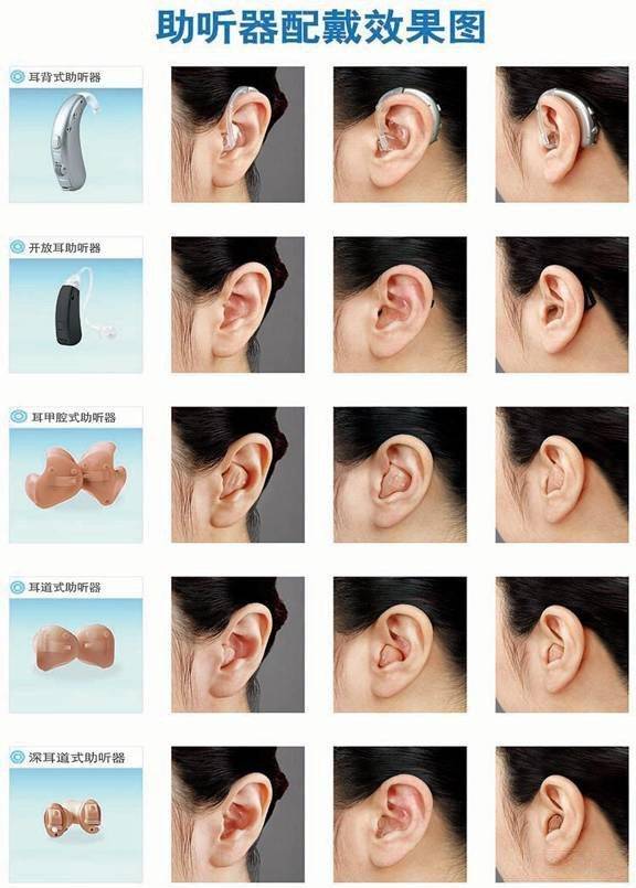 助听器有几种，各有什么优缺点如何选购？
