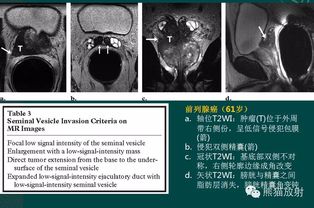 mri和nmr,MRI: MRI的基本原理。