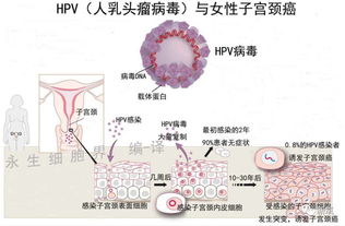 2023国家hpv政策（hpv新政策）,2023国家HPV政策：全民接种计划 