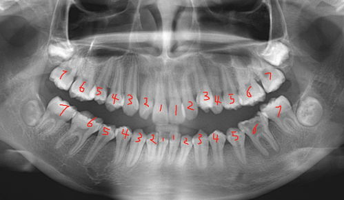 正常人有多少颗牙齿呀 
