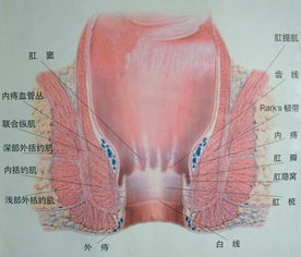 肛瘘症状 肛瘘是什么症状表现