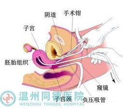 怀孕多久可以做人流 栏目 jdzj.com 