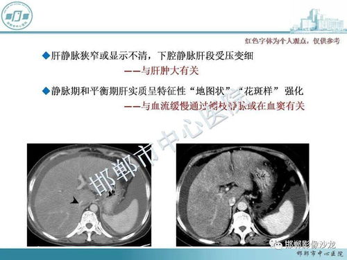 从解剖病理入手,诠释影像表现