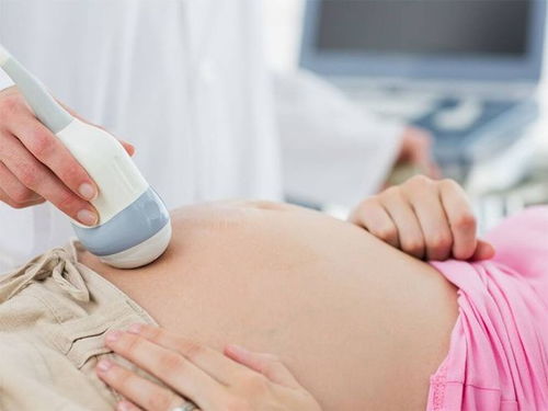 产检发现胎儿发育大小和孕周数不符怎么回事呢(胎儿发育大小与孕周不符)
