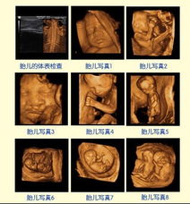 胎儿四维彩超图？四维彩超查胎儿的哪些部位