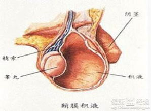 鞘膜积液看什么科,鞘膜积液就诊指南