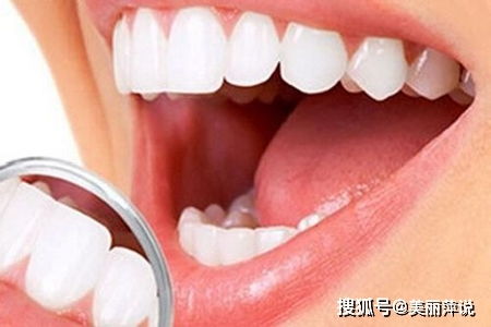 为什么要洗牙 掌握洗牙知识保卫口腔健康