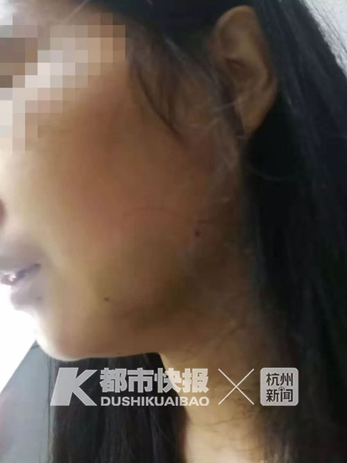 妈妈为保护孩子被遛狗不牵绳的男子殴打 警方处理结果来了