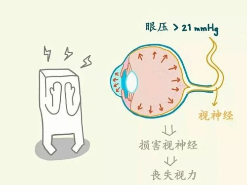 干货 高度近视不要做头倒立