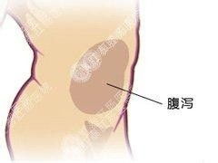 吃坏东西肚子痛怎么办