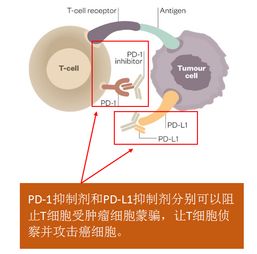 非小细胞肺癌治疗是否该选择免疫治疗