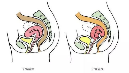 女性腰疼是什么原因，该怎么治疗