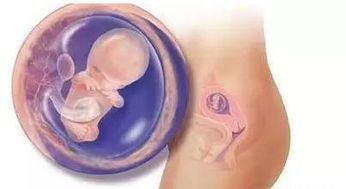 孕期死胎有什么症状