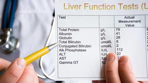 转氨酶怎么检查？一文详解检查流程与注