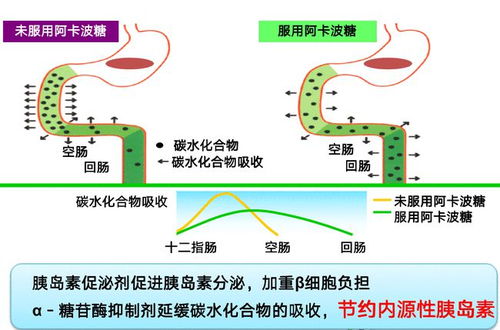 阿卡波糖是如何正确控制血糖的