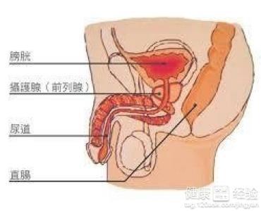 前列腺增生症症状 前列腺肥大有哪些症状