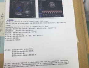 在不做B超的情况下我怎样才知道宝宝在肚子里面好不好啊