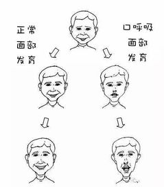 吓坏人 5岁男孩睡觉呼噜打得震天响,医生 会拉低颜值 媒体 ... 