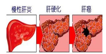 安钧璨因肝癌去世,人体肝脏有多重要 