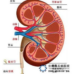 肾囊肿饮食注意什么 肾结石 胆结石 保胆保肾取石 亚洲专业治疗结石病的医院 