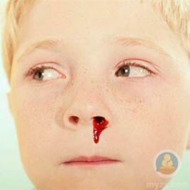 小儿鼻出血，幼儿流鼻血处理方法