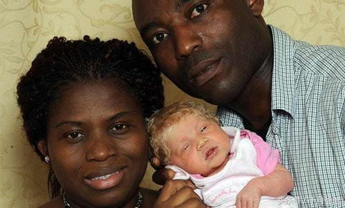 黑人父母生出白肤色宝宝,新生儿的肤色是如何确定的 