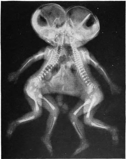 一些奇奇怪怪的X光片,看得整个人不好了,到底是怎么拍出来的 